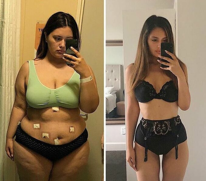 Gadis sebelum dan sesudah penurunan berat badan dengan kapsul KETO Complete